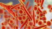 Kemenkes: 6 Kasus Pneumonia Mycoplasma di Indonesia Dinyatakan Sembuh. Ilustrasi. (Shutterstock).